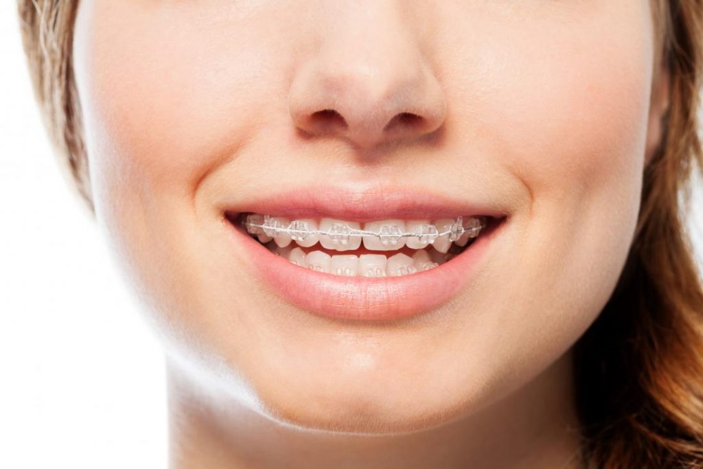 All One Needs to Know About Orthodontist Treatments